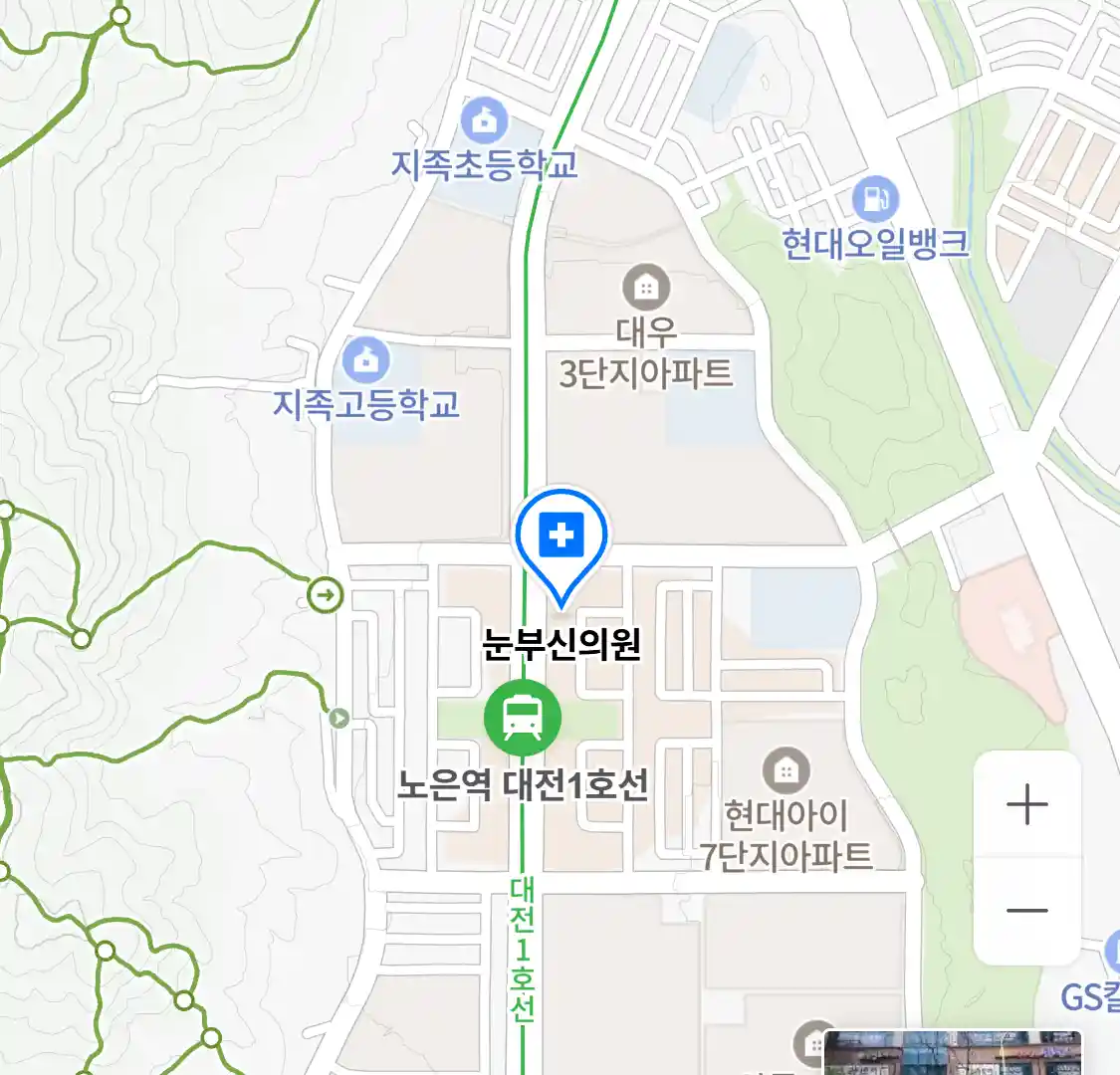 눈부신의원 위치