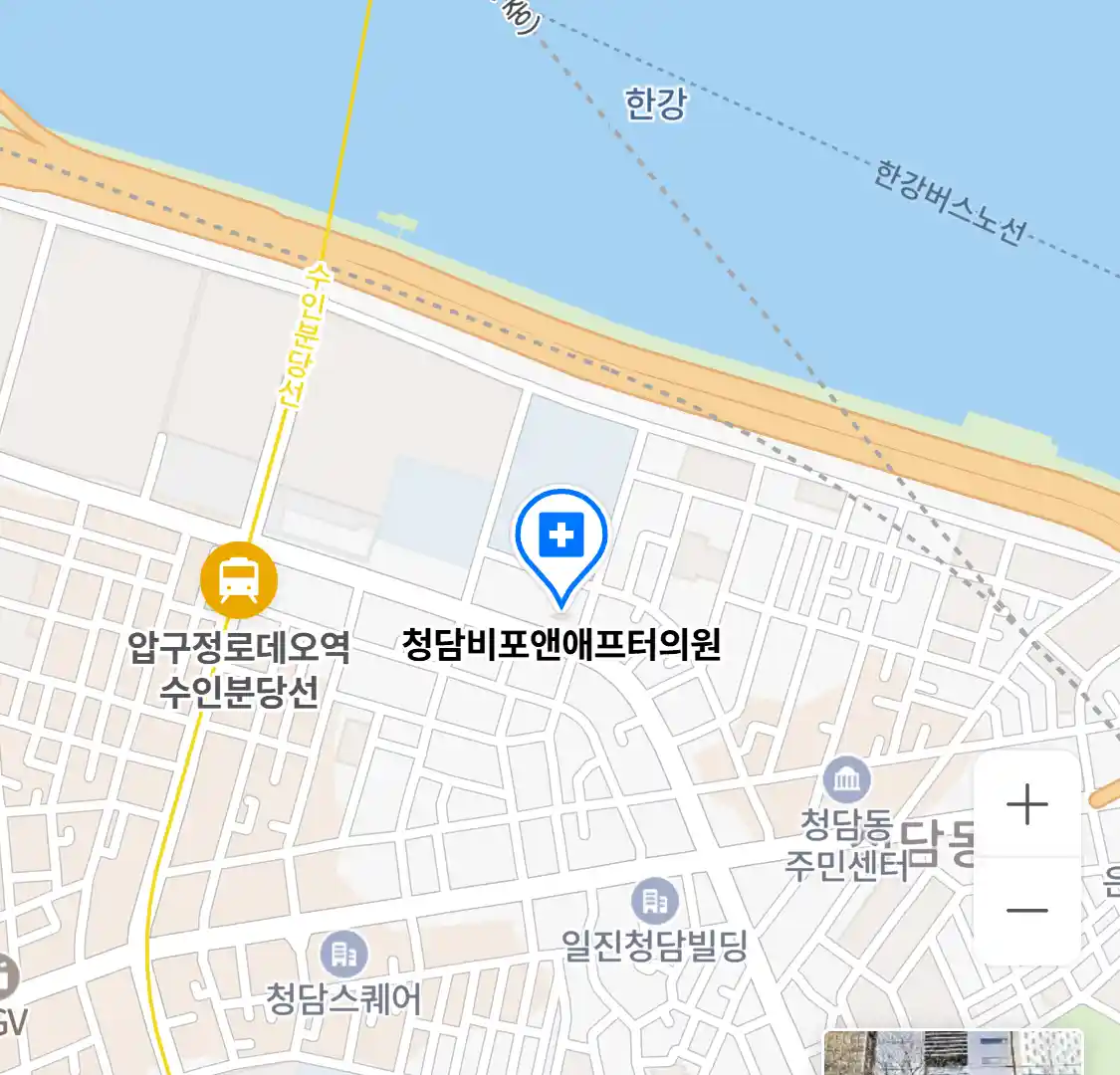 청담비포앤애프터의원 위치