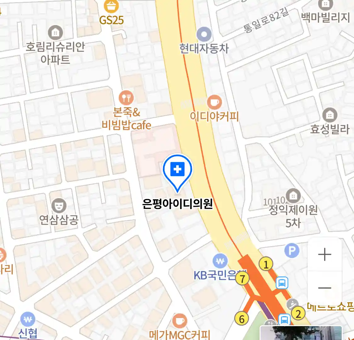 은평아이디의원 위치